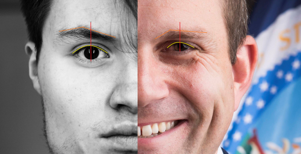 Comparison of two faces, one showing a prone eye and eyebrow and the other showing a supine eye and eyebrow, indicating that prone eyes can suggest being a T type, while supine eyes can suggest being an F type, according to the facial reading system of Physiotype.