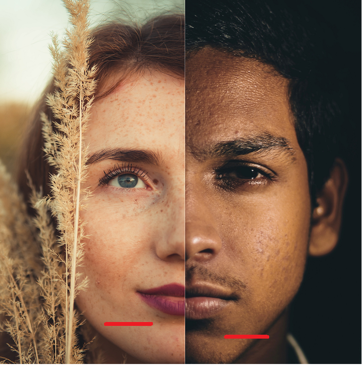 Comparison of chin lines showing differences in appearance based on personality type. Physiotype, a system related to MBTI, socionics, and Objective Personality System, uses the labiodental crease to predict personality type.